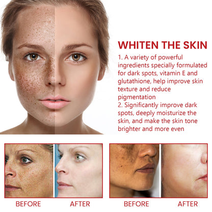 Dark Spot Repair Cream eprolo